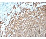 CD20/ MS4A1 （B-Cell Marker） 100ug