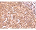 CD20 / MS4A1 （B-Cell Marker） 20ug