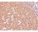 CD20 / MS4A1 （B-Cell Marker） 100ug