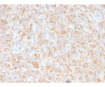 TNF-alpha （Tumor Necrosis Factor alpha） 100ug