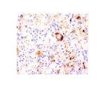 TNF-alpha（TumorNecrosis Factor alpha） 20ug
