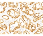 p53 Tumor Suppressor Protein 20ug