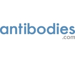 Anti-GluR-＆#0948;2 （G860） Antibody 50ul
